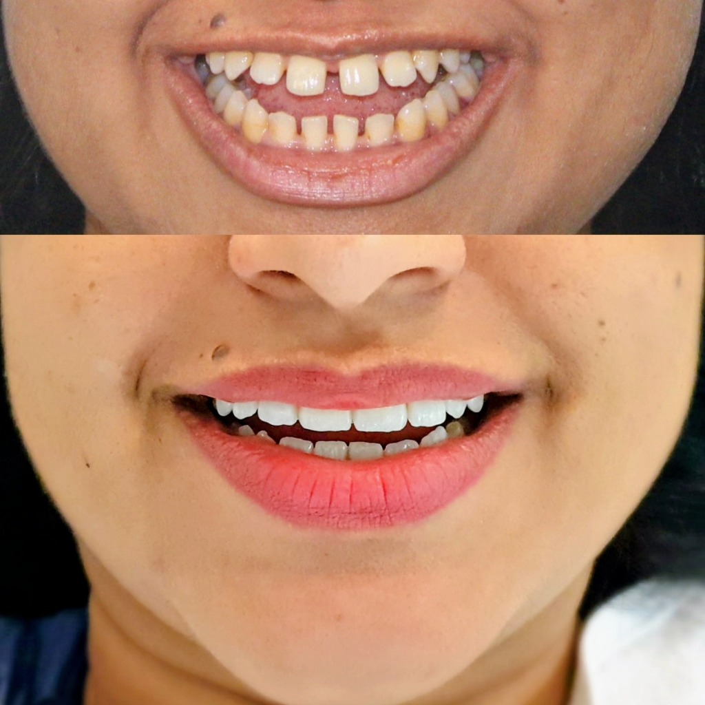 Real Patient Result 3 Before